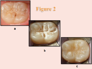 Best Dental Clinic in Wakad, Dental Clinic Near Me in Wakad